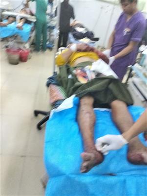 မန္တလေးမြို့တော်ဝန်သင်္ကြန်မဏ္ဍပ်အနီးရှိ ဆိုင်ကယ်စတင်းတွင် ဗုံးပေါက်ကွဲမှု ၂ ခုဖြစ်